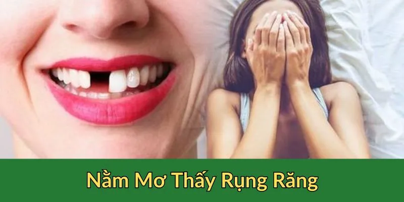 Thông tin sơ qua về việc nằm mơ thấy rụng răng